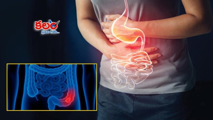 Appendicitis