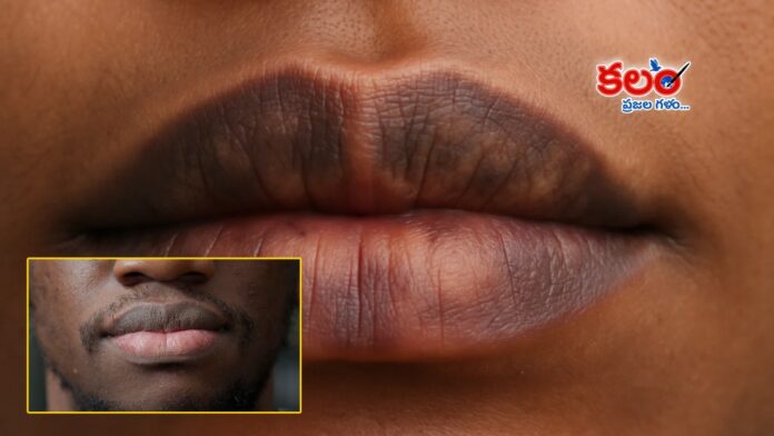 Lip Care Tips