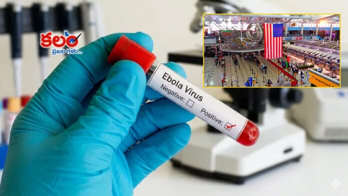 Ebola