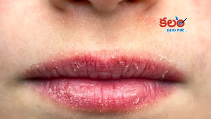 Lip Care