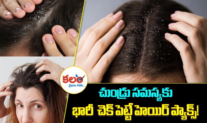 Dandruff Control Tips