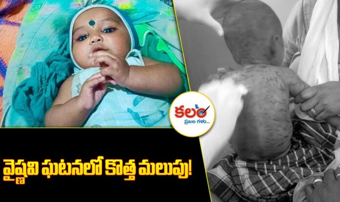 Baby Attack Case