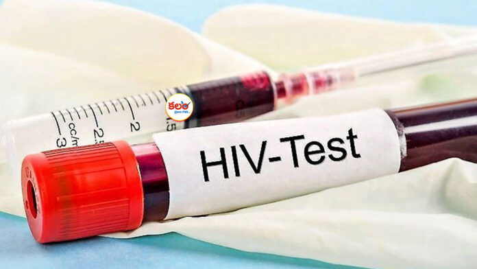 HIV