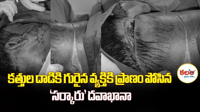 Kothagudem