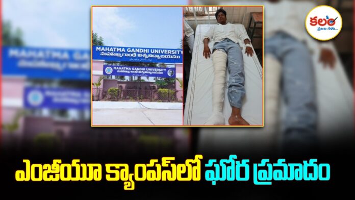 MG University Accident
