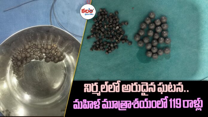 Bladder Stones